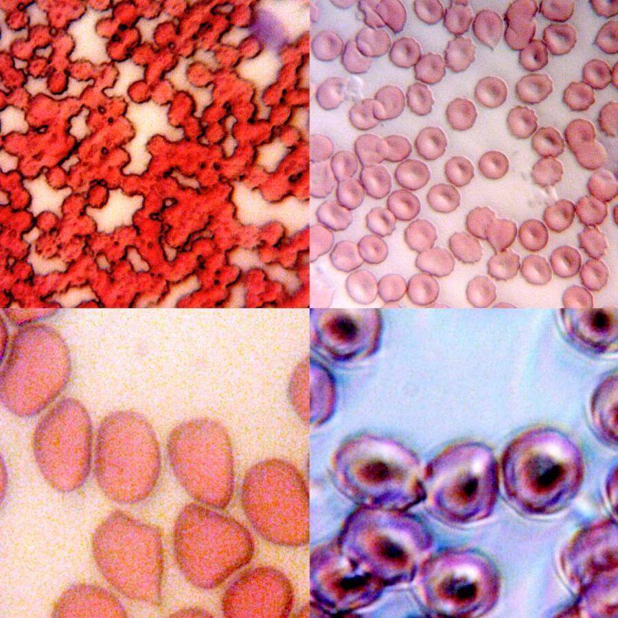 picture of Blood poster